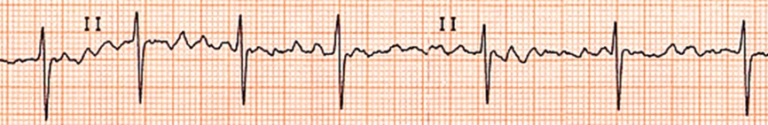 /mnt/user-data/uploads/1776609519850_EKG_1_Preop.jpg