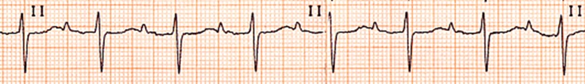 /mnt/user-data/uploads/1776609519849_EKG_4i_yirmibeşinci_gün.jpg